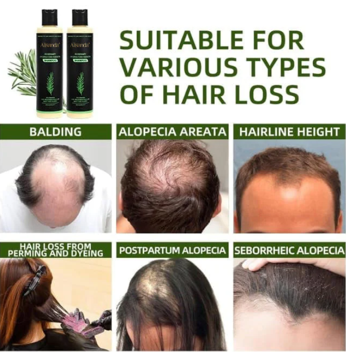🔥LAST DAY 50% OFF - 🎅Alisanda® Organic Rosemary Hair Growth Shampoo
