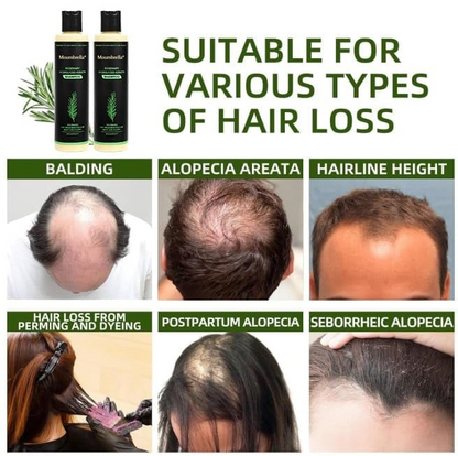 🔥LAST DAY 50% OFF - 🎅Moumbrella® Organic Rosemary Hair Growth Shampoo