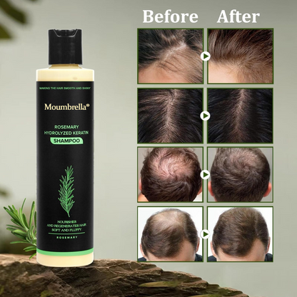 🔥LAST DAY 50% OFF - 🎅Moumbrella® Organic Rosemary Hair Growth Shampoo